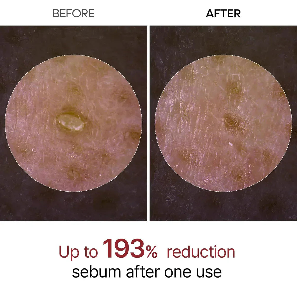 NavaGlow Dr. Melaxin Rice Peel Ampoule - Buy 2 Get FREE Collagen Mask